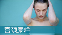 宮頸糜爛怎么治療_西寧婦科醫院