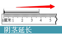 陰莖短小治療_西寧男科醫院